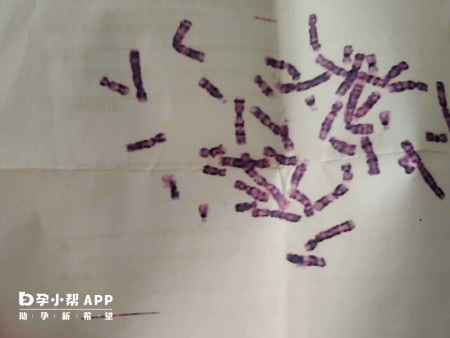 染色体异常可以做三代试管婴儿