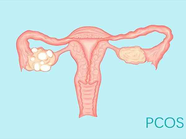 海口做多囊卵巢手术的医院真不少，这份名单赶紧收藏起来