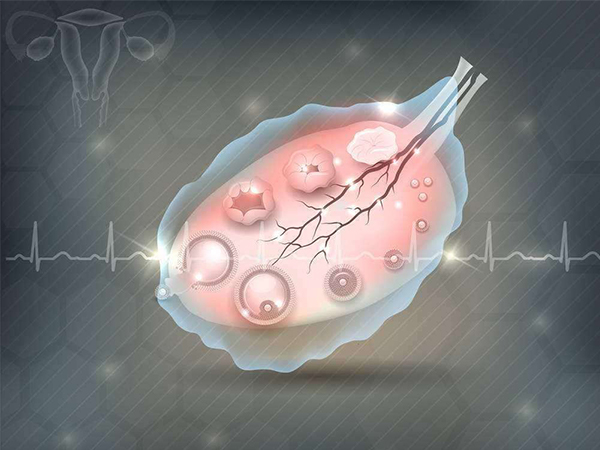 空卵泡取卵成功率不高