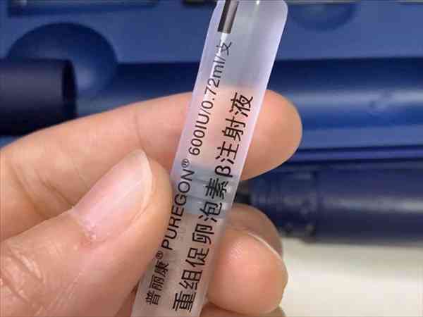 试管黄体期长方案适合五类人，卵巢功能良好算是其一